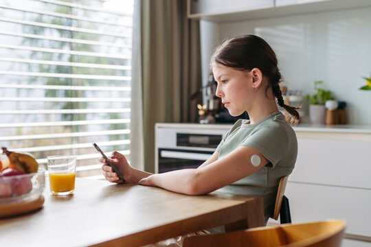 Teen girl with diabetes scanning glucose level using CGM sensor and smartphone.