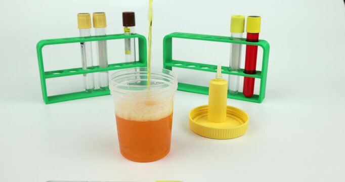 An empty sterile plastic container being filled with a yellow liquid urine sample from a patient isolated on a white background
