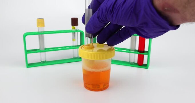 Detailed view of hands in blue gloves extracting a urine sample using a sterile vacuum test tube isolated on white background