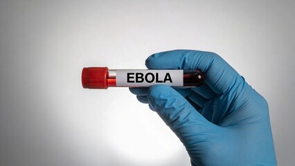 Obraz premium A gloved hand holds a blood test tube labeled EBOLA in a laboratory setting.
