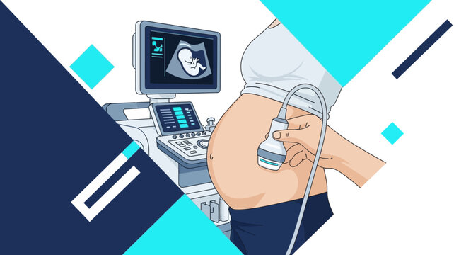 Illustration Of Expectant Mother Undergoing Echography Ultrasound Examination