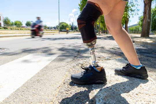 Person with disability standing at a zebra crossing, featuring a prosthetic leg and an artificial limb for mobility