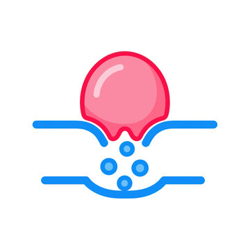 Illustration of skin pore with acne and sebum