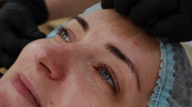 A female doctor, a professional cosmetologist, prepares a patient's face for a procedure