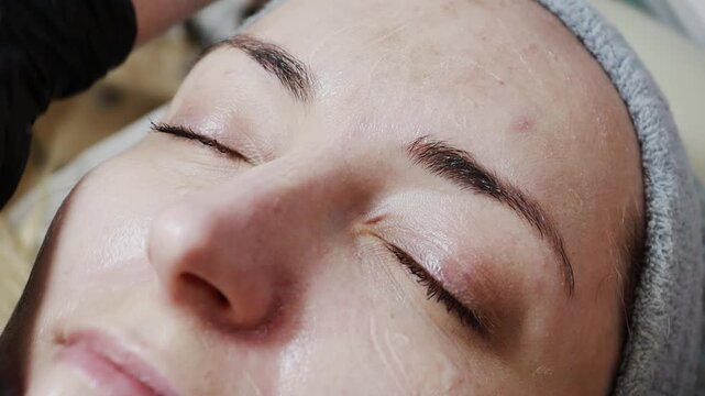 A female doctor, a professional cosmetologist, prepares a patient's face for a procedure