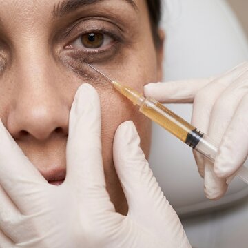 Gloved Hands Injecting PRF into Dark Sunken Under Eye Skin