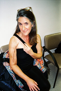 Portrait of woman with surgical scar at doctor's office