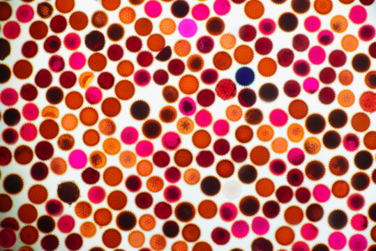 Microscopic View of Pollen Grains and Spores. 