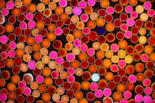 Microscopic Dark field View of Pollen Grains and Spores. 