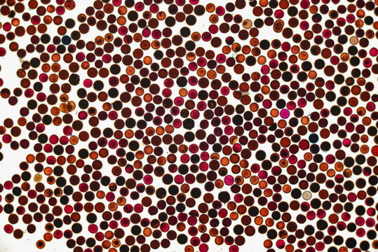 Microscopic View of Pollen Grains and Spores. 