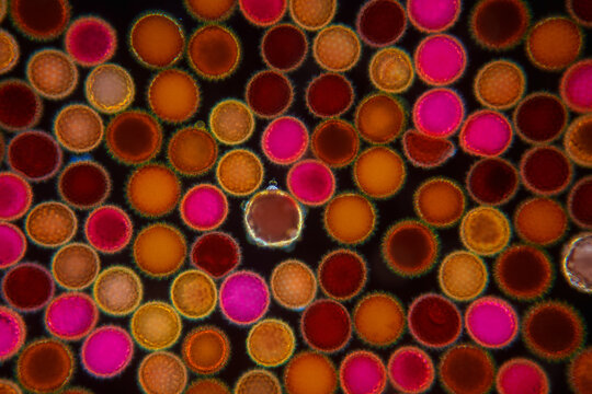 Microscopic Dark field View of Pollen Grains and Spores. 