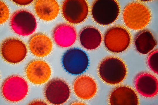 Microscopic DIC View of Pollen Grains and Spores. 