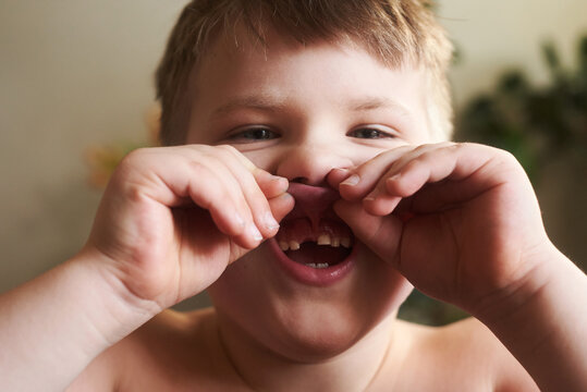 Lost Front Tooth