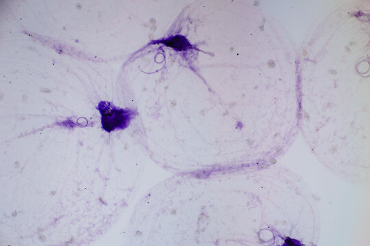 Micrograph of Noctiluca Scintillans