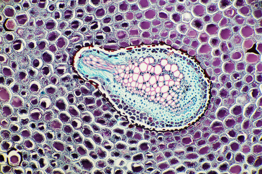 Micrograph of Plant Stem Parenchyma Cells