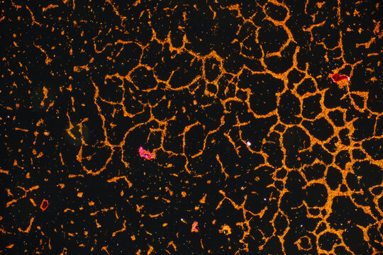 Micrograph of Bacillus anthracis Smear