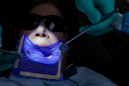 Patient receiving root canal therapy during endodontic procedure in dental clinic. with the hands, dental instruments, mirror, rubber dam isolation, and tweezers.