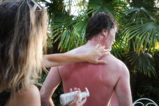 Person Applies Sunscreen to man in Garden