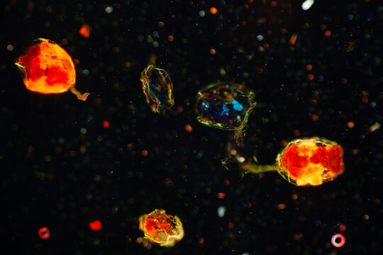 Micrograph of Rotifer Under Microscope
