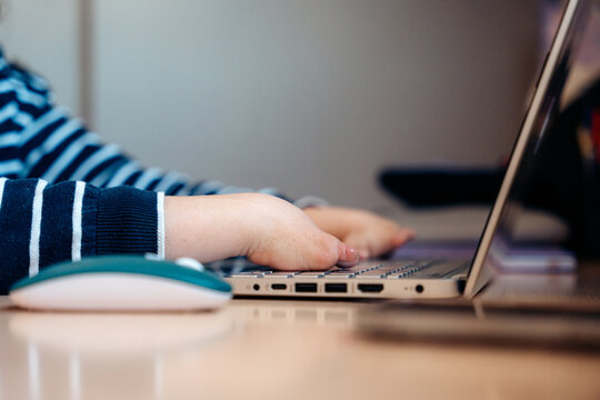 Woman with disability typing on laptop computer