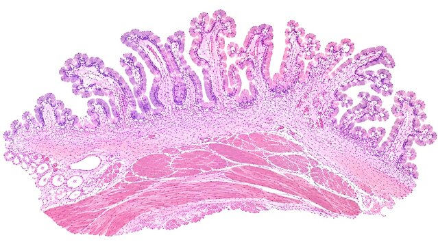Histology photomicrograph of normal human gallbladder tissue stained with hematoxylin and eosin (H&E), characteristic mucosal folds, simple columnar epithelium, lamina propria, and smooth muscle layer
