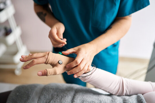 Patient receiving hand neurostimulation therapy