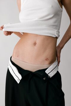 Torso with surgery scars