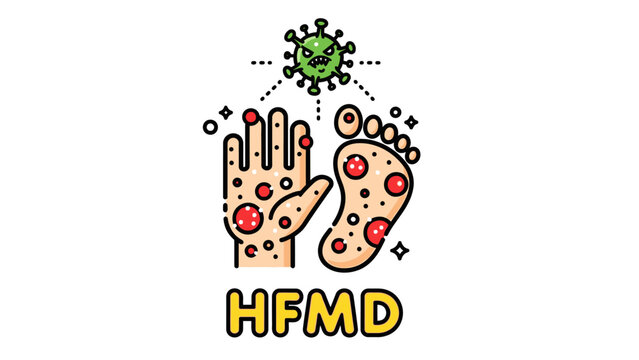 Vector illustration of Hand, Foot, and Mouth Disease (HFMD) symptoms, featuring a virus icon above an infected hand and foot, suitable for medical awareness and educational health concepts.