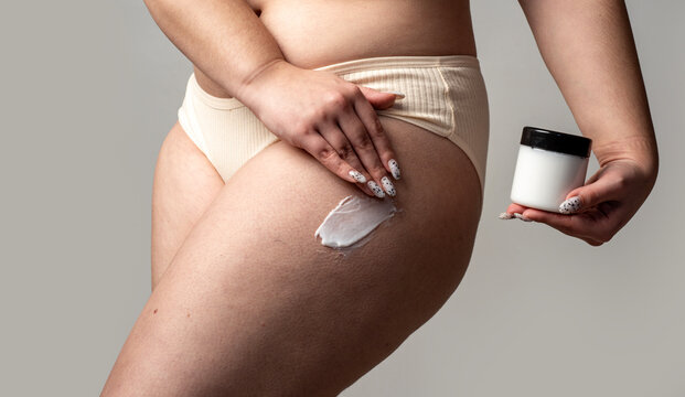 Cellulite on thigh with buttocks and realistic skin. Anti cellulite cream for thigh and body. Healthcare anatomy for cellulite on thigh. Natural body with cellulite on thigh.