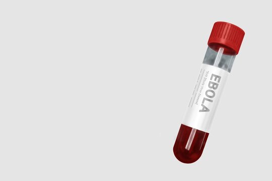 test tube with blood identification ebola virus