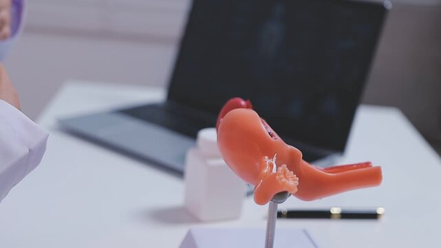 Doctor holding human uterus model for vaginal and cervix pap smear check up in the obstetrics and gynecology.