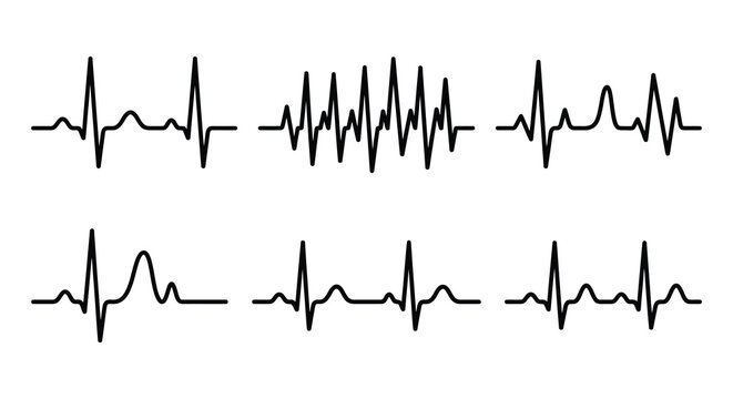 electrocardiogram waves in silhouette ecg heartbeat medical healthcare diagnosis monitoring