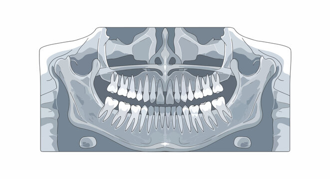 A detailed dental X-ray image of a human skull with teeth and jawbone on a white background.