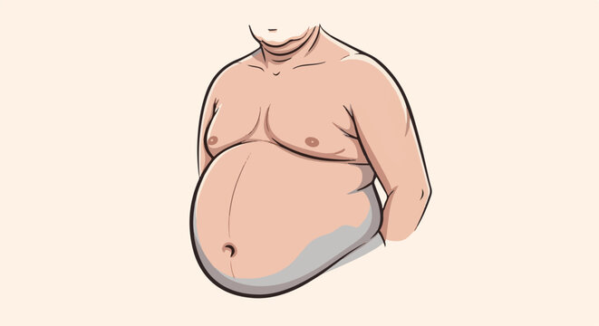 Illustration of a person's torso with significant abdominal girth and neck folds