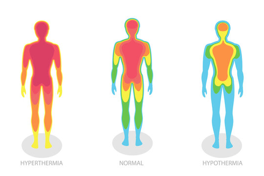 3D Isometric Flat  Illustration of Human Body Temperature, Hyperthermia And Hypothermia