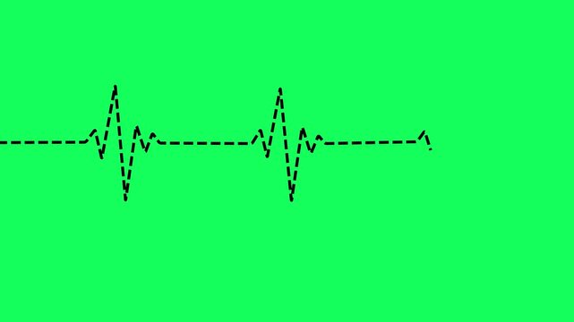 Dashed heartbeat and pulse line animation on green background. Electrocardiogram dot line traces a heartbeat pattern. Heartbeat monitor ECG line animation for symbolizing life, health, medical signal