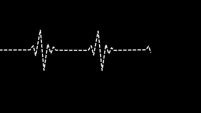 Dashed heartbeat and pulse line animation on black background. Electrocardiogram dot line traces a heartbeat pattern. Heartbeat monitor ECG line animation for symbolizing life, health, medical signal