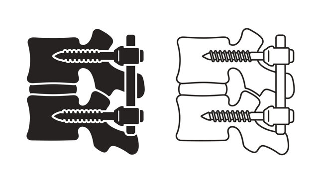 screw and nut orthopaedic surgery  