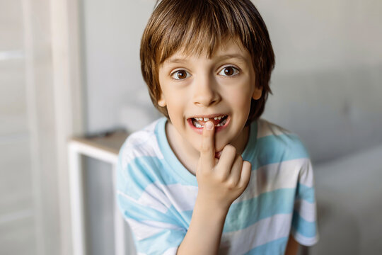 Little boy showing his missing front tooth and smiling. Child losing milk teeth.