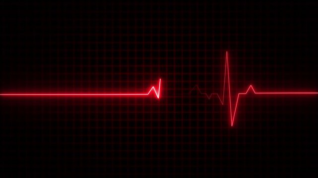 Monitoring in an emergency ecg line animation. heartbeat signal icon cardiogram motion graphics. Medical concept EKG Pulse Wave.