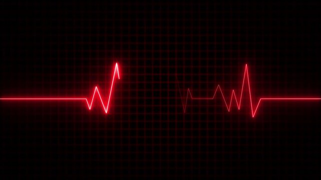 Monitoring in an emergency ecg line animation. heartbeat signal icon cardiogram motion graphics. Medical concept EKG Pulse Wave.