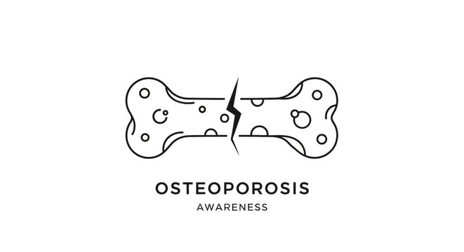 Broken bone illustration highlighting osteoporosis awareness concept.