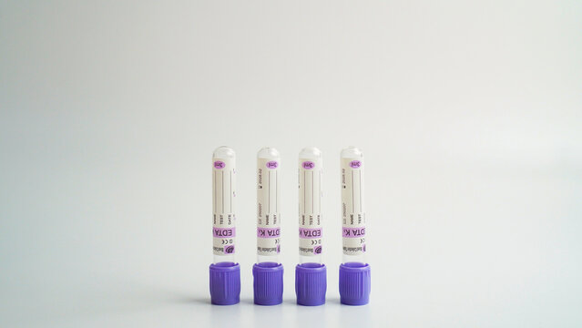 Tangerang Selatan, Indonesia - February 6, 2026 - Four EDTA blood collection tubes with purple stopper caps standing upright on a white surface, used for laboratory blood sample identification.