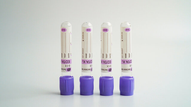 Tangerang Selatan, Indonesia - February 6, 2026 - Four EDTA blood collection tubes with purple stopper caps standing upright on a white surface, used for laboratory blood sample identification.