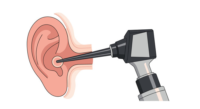 Medical illustration of an otoscope being used to examine the internal structure of a human ear canal for checkup.