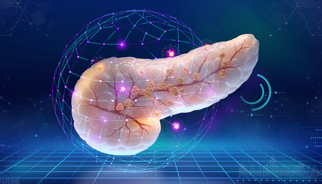 Conceptual medical artwork shows ai medical imaging pancreatic cancer screening with advanced computed tomography