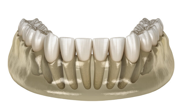 Human lower jaw with teeth and bone structure