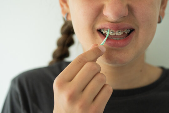 A teenage girl uses an interdental brush to clean between her braces at home, demonstrating proper oral hygiene and orthodontic care. Dental care product ads, orthodontic clinic brochures