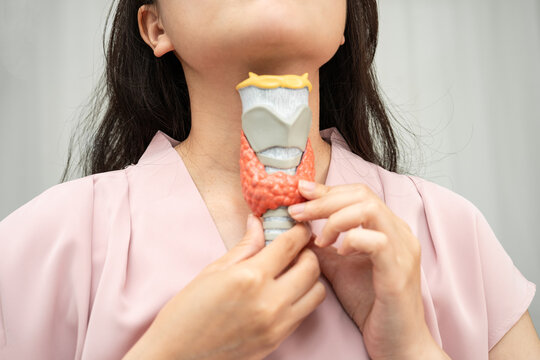 Hyperthyroidism, Overactive Thyroid, Thyroid Lymphoma, Asian woman with thyroid gland human anatomy model.