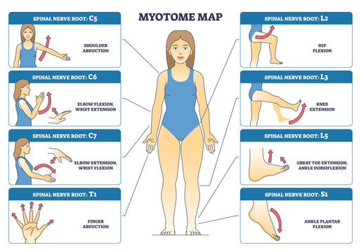 Myotome map shows spinal nerve roots driving muscle actions across the body, key objects, central human figure, labeled nerve roots, motion arrows. Diagram